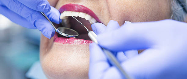 Best Emergency Treatment for Toothache in White Hall, IL