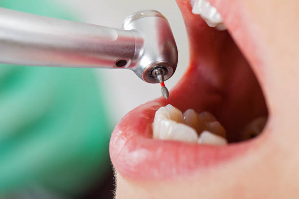 Best Emergency Dental Surgery in White Hall, IL